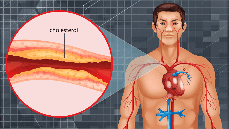 Colesterolo HDL e LDL bioenergy nutrition integratori sportivi alimentazione cuneo