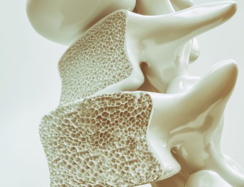 Fattori di rischio dell’osteoporosi