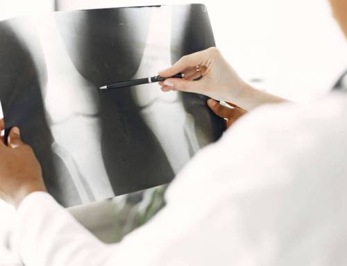 Osteoporosi, cose da evitare